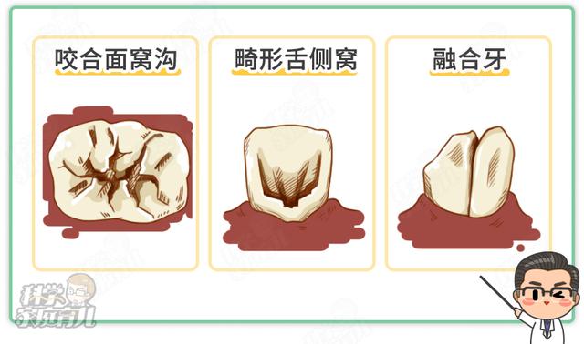 幸福相守|有些事牙科医生不轻易告诉你！窝沟封闭≠一劳永逸！后续做好3事