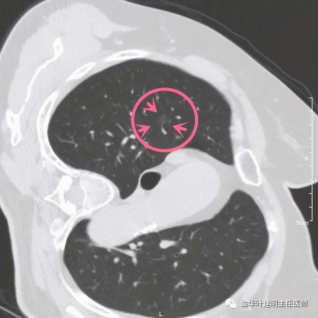 如此违反原则的手术方案设计，你支持吗？