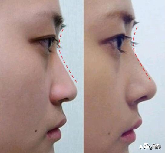 为什么95年的虞书欣一个素颜就老成这样|资讯早知道