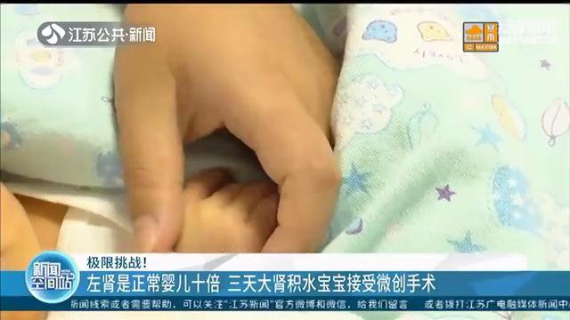超级宝妈|左肾是正常婴儿十倍!出生三天的宝宝肾积水接受微创手术