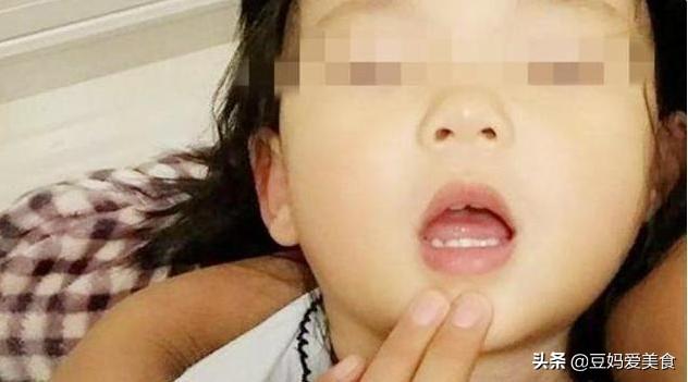 安全港|3岁女儿鱼刺卡住喉咙，妈妈第一时间这样处理，医生赞不绝口