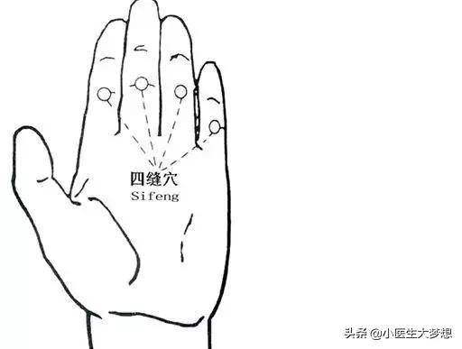 你的育儿经|小儿挑食长不胖，针四缝穴