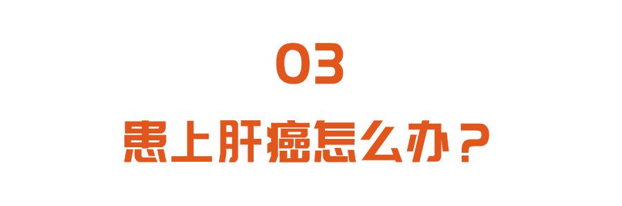 肝癌|肝癌一发现就是晚期？学会看体检这几项，早早预防，阻断肝癌发展