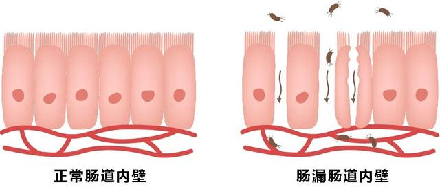 抗生素，是如何伤害肠道的？有什么方法拯救它？