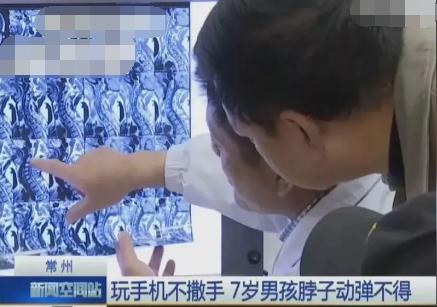 男孩“落枕”一波操作后竟差点瘫痪！孩子脖子疼，家长一定要当心