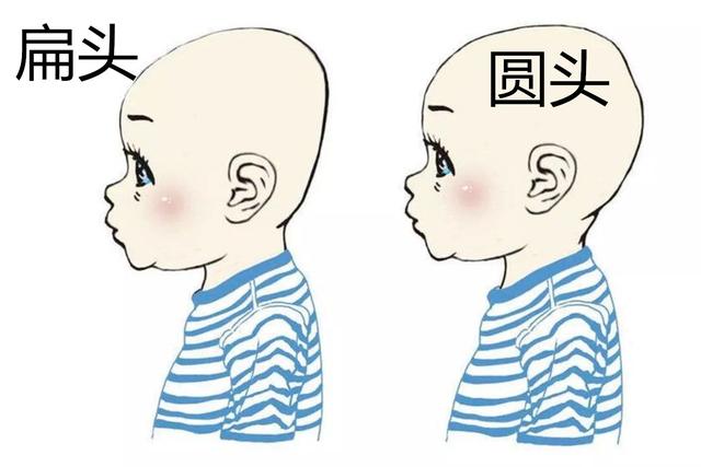 【天使宝贝】为何老一辈坚持给宝宝“睡扁头”，很影响宝宝的颜值，不信你看