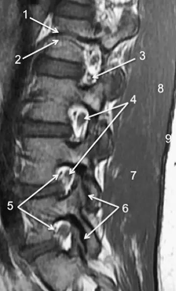 ռ׵ MRI ͼ