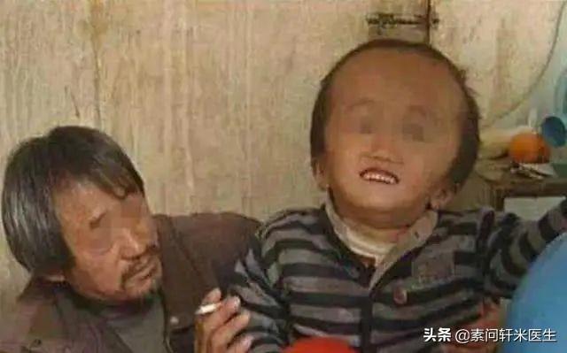 『你的育儿经』过敏宝宝的家长请注意！又见“大头娃娃”，害人的假奶粉还在卖