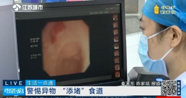 刘洋|异物卡喉咙，小道偏方不可取……