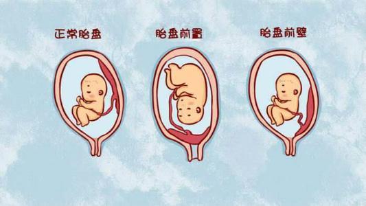 【你的育儿经】孕期胎盘前置不要害怕，孕妈做好这4点，胎盘慢慢长上去