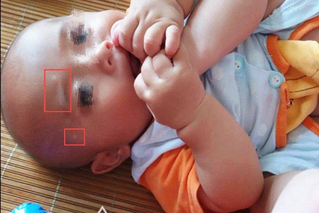 超级宝妈：若孩子肚子里有蛔虫，会出现这些“信号”，家长速查你家娃有吗？
