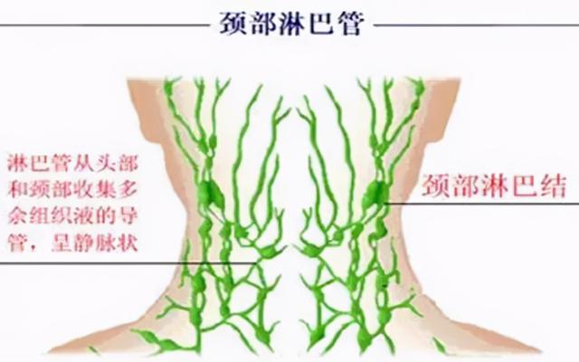 淋巴不通，一身是病！艾灸淋巴，不止美容还可续命