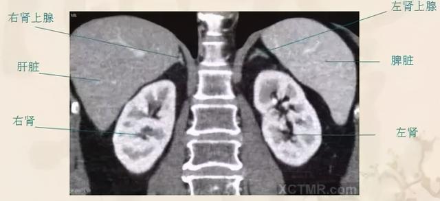 影像解剖：胸、腹部、盆腔CT解剖