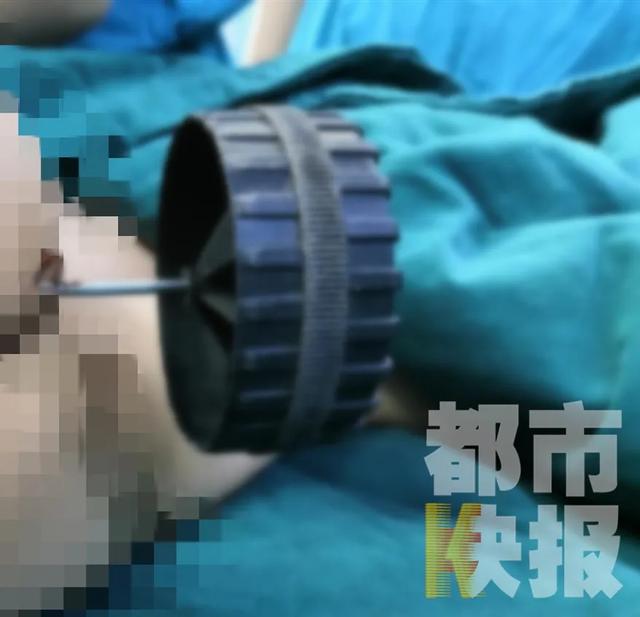 【超级宝妈】12厘米长钢针扎入体内，男童西安紧急就医！儿童玩具要当心
