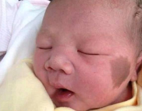 超级宝妈：怀孕后，孕妈尽量别做4件事，小心宝宝脸上长胎记