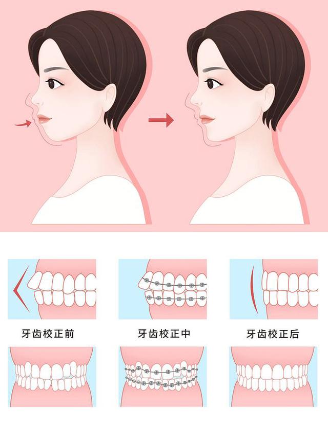 政策再度调整！人均2500元，2021年百万补贴在线申领，速领