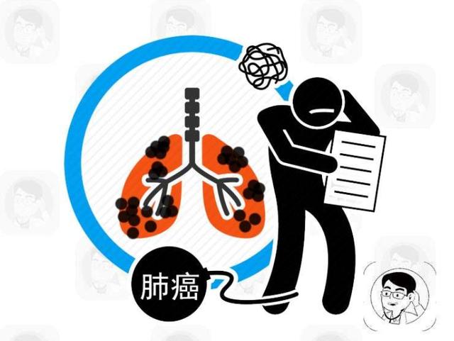 肺癌一发现就是晚期？医生：若近期上半身出现4个异常，别忽视