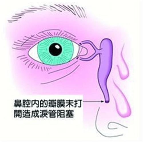 『你的育儿经』宝宝眼泪多、眼部分泌物多、眼周湿疹，如何轻松在家搞定