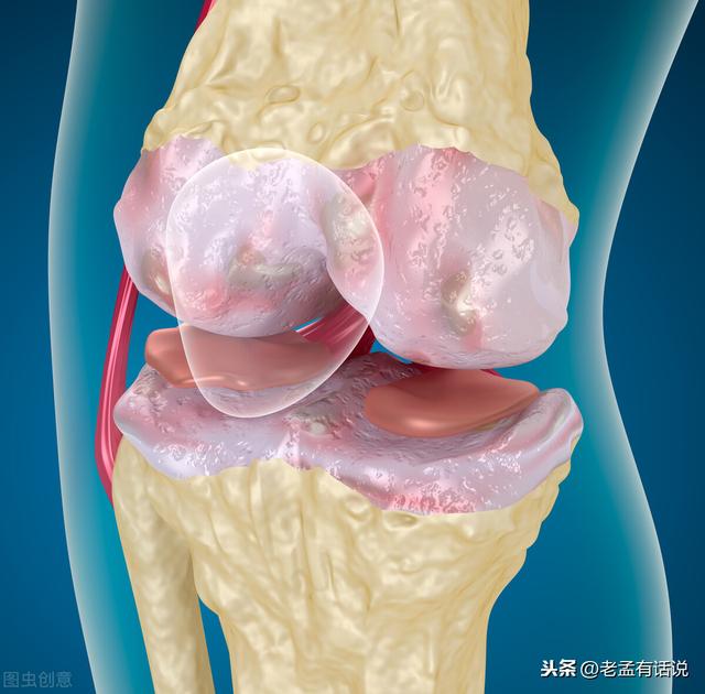 关节痛打封闭针，消炎止痛效果好！但容易留下3种副作用