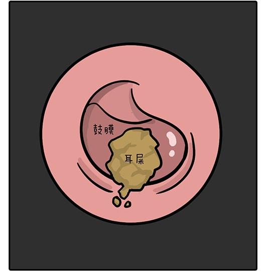 外耳道|耳屎宝宝好处多，闲来无事不要掏