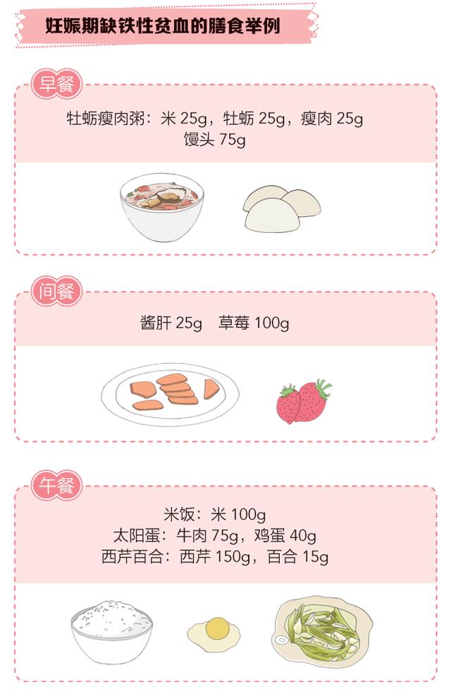 人卫|缺铁性贫血：孕期不可忽视的一个问题