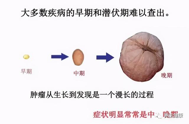 年年体检都正常为何突然被查出癌症晚期？