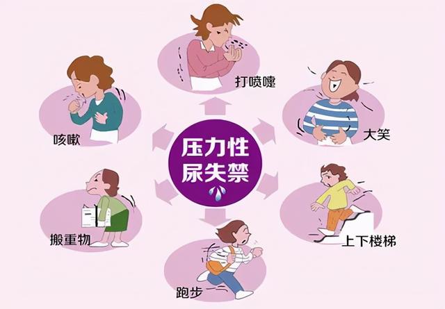 “女性的第二张脸——盆底肌”、告别尴尬，有妇产科医生帮你忙