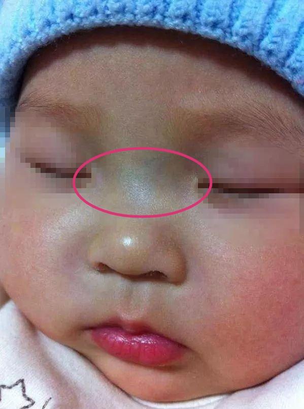 超级宝妈|儿科主任：娃有5种现象，说明孩子养成“病秧子”了，别不在意