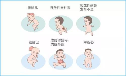 笑看人生|孕中期检查项目及畸形儿检查，你知道多少呢？