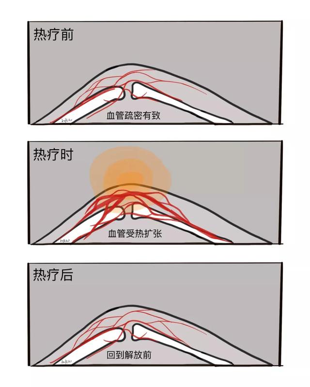 膝关节一活动，时不时传来“咔咔咔”的响声，需要治疗吗？