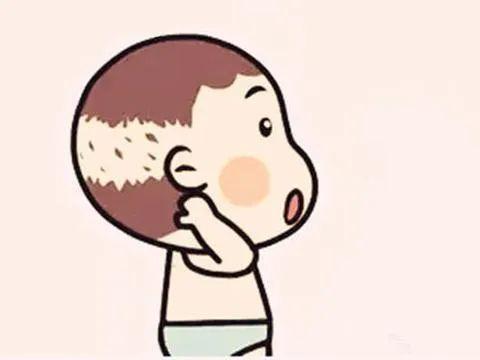 脱发|人家还是个宝宝，怎么也“秃”了……