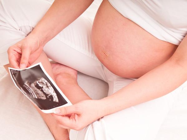 「你的育儿经」普通B超、三维彩超、四维彩超有啥区别？一一讲清楚，孕妈需了解