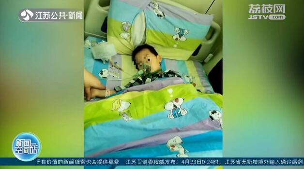 【你的育儿经】3岁男童吞下41颗磁力珠 导致两处胃穿孔 医生紧急手术救命