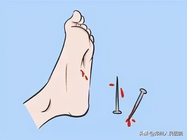 就是这个小东西，差点要命