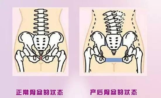金牌大叔|产后修复到底管不管用？到底骗不骗人？