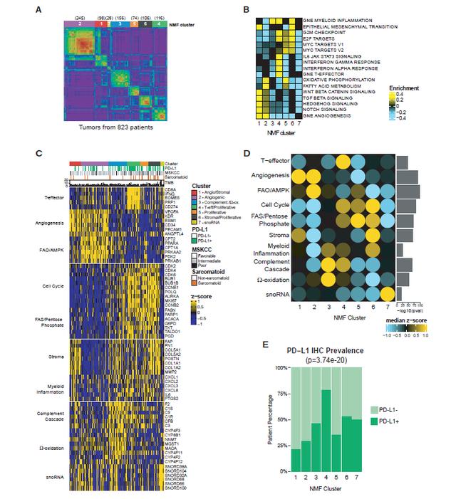 「RCC文献月评-9」专家领读肾癌领域最新文献及研究进展