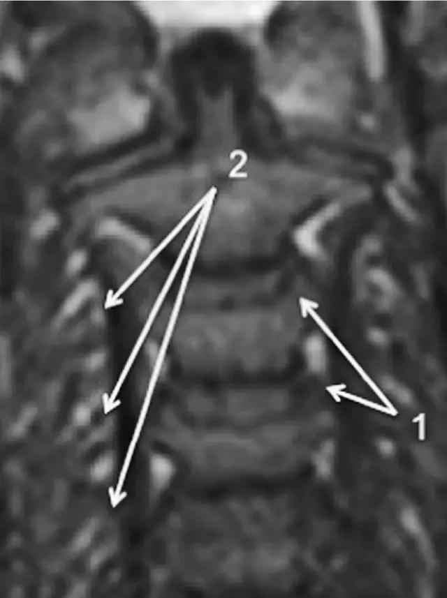 ռ׵ MRI ͼ