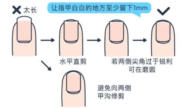 指甲|有些人表面光鲜亮丽，背地里偷偷用脚后跟走路