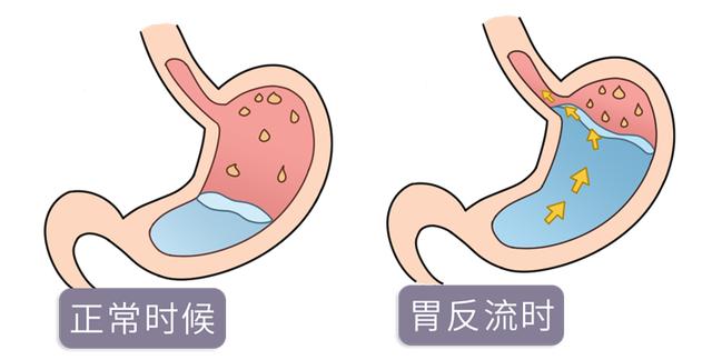 10个常见的饭后习惯，其中有6个很伤身，很多人还在天天做