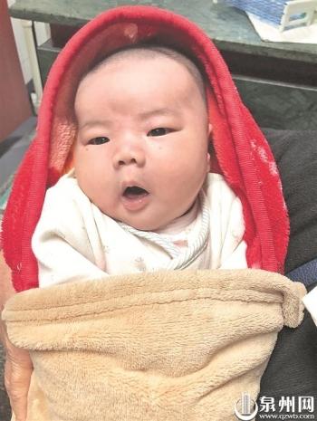 【台海网】泉州:女子产10.2斤“巨婴”遭遇“肩难产”