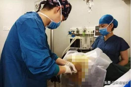 『超级宝妈』剖腹产很容易的，产妇说疼都是矫情，这句话遭受产妇怒斥