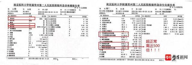 溶解|200个深蹲过后，常州一初中生险些血透！龙虾季又到了，出现酱油尿要重视