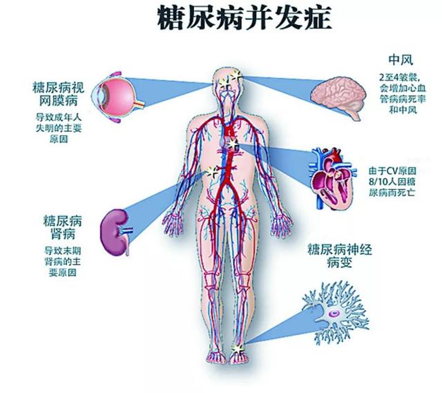中国进入“糖朝盛世”，作为糖民，要特别警惕“糖网”的出现