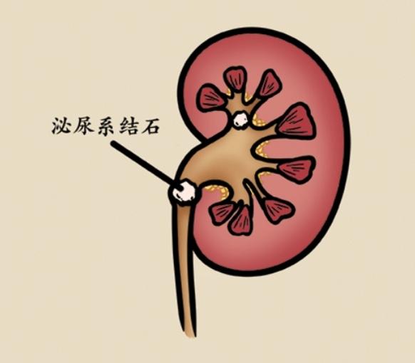 喝水|喝水这件小事，你真的做对了吗？