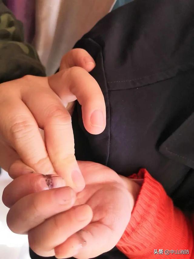 [你的育儿经]急哭！南昌一小女孩手指被自行车链条卡住，家长们可千万看住了！