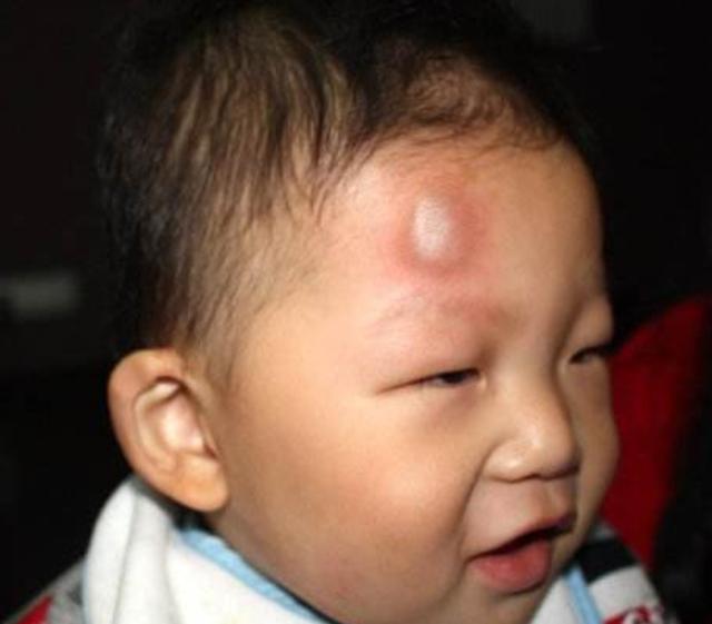 1岁宝宝摔下床，妈妈的做法让婆婆直呼冷血，医生却说：做的对