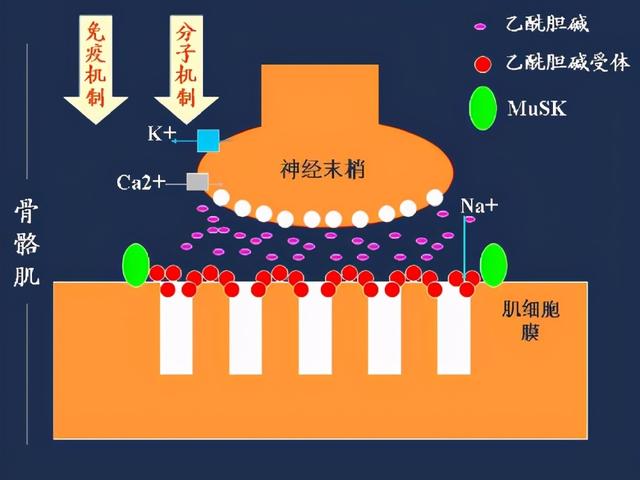 干燥综合征？抑郁症？还是重症肌无力？误诊可能带来生命的危险