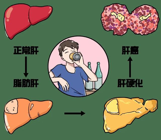 【健康提醒】轻度脂肪肝也会增加71%的死亡风险……小病千万莫忽视！