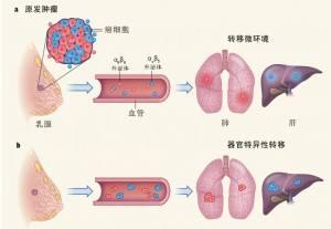 大肠癌|化疗对于癌症患者是把双刃剑，哪些大肠癌患者需要做化疗？