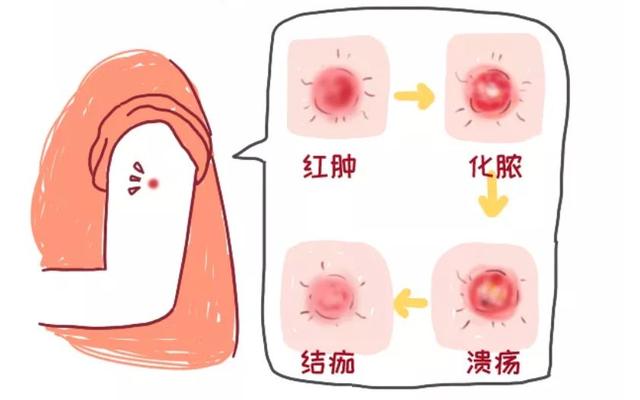 #超级宝妈#关于儿童接种疫苗后不良反应的那些事儿，你都处理对了吗？